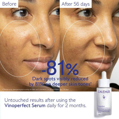 Caudalie Vinoperfect Brightening Dark Spot Serum (30ml)