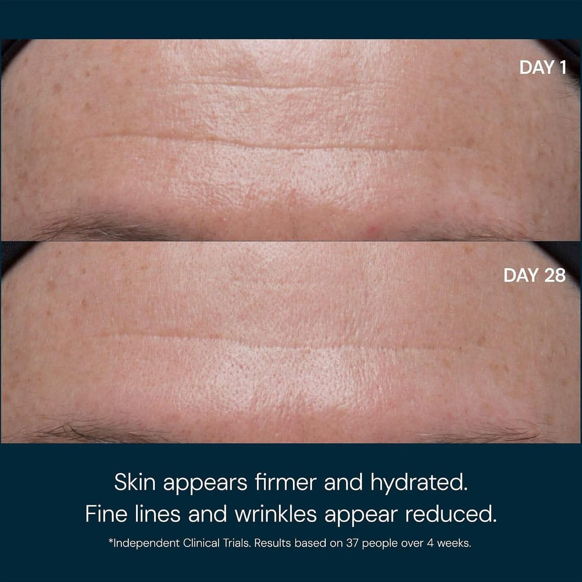 Radiant Glow Anti-Wrinkle Cream
